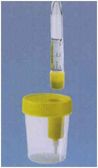 Одноразовый стерильный контейнер с устройством для переноса мочи в пробирку (клапанная крышка), 100 мл.