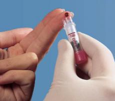 Microvette® 300/500 – Взятие капиллярной крови по принципу самотека